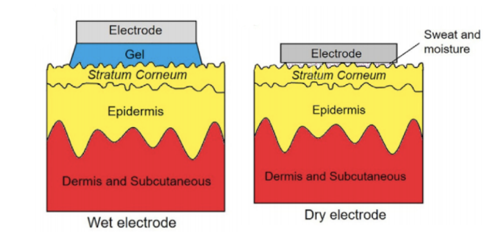 ECG