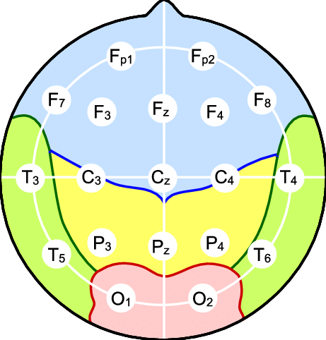 ECG